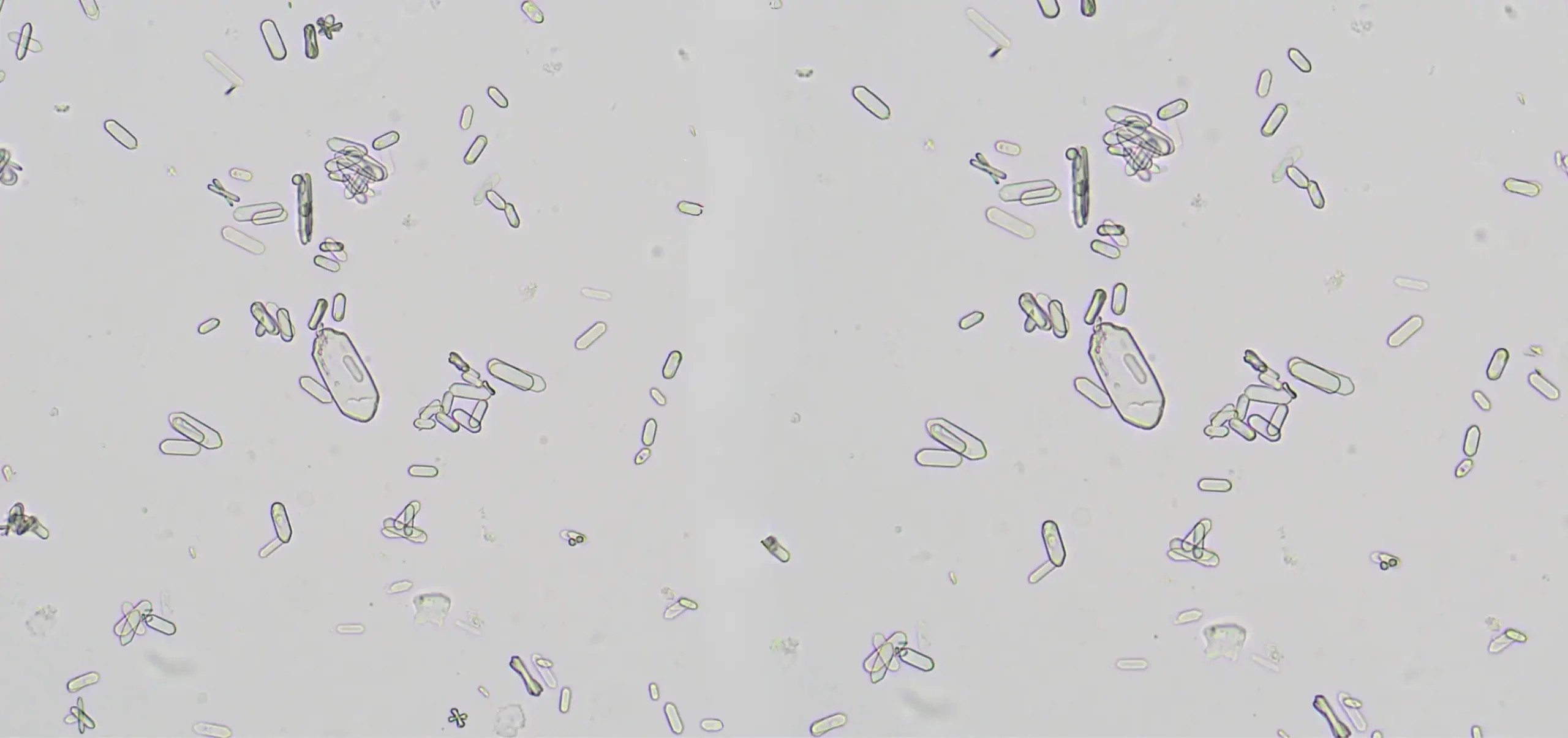 Kedilerde Kristalleşme Banner Resmi